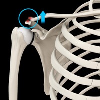 A/C Joint Dislocation